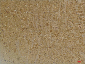 GABA B Receptor 2 Polyclonal Antibody