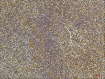 CXCR4 Polyclonal Antibody