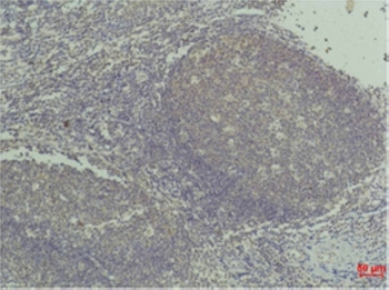 TNF α Monoclonal Antibody(Q36)