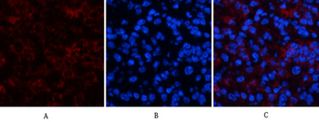 p70 S6 kinase α Polyclonal Antibody