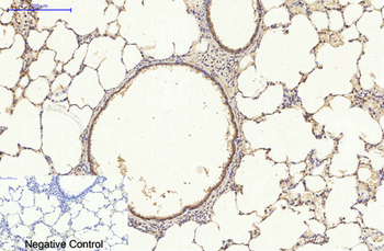 p70 S6 kinase α Polyclonal Antibody