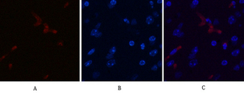 p70 S6 kinase α Polyclonal Antibody