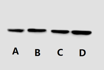 p70 S6 kinase α Polyclonal Antibody