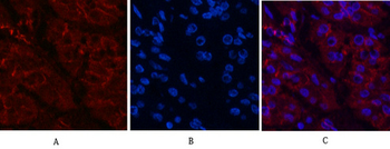 Catenin-β Monoclonal Antibody(4F2)
