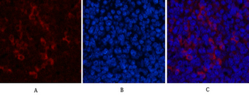Catenin-β Monoclonal Antibody(4F2)