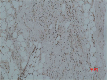 CALHM1 Polyclonal Antibody