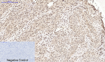 Histone H4 (Acetyl Lys16) Polyclonal Antibody
