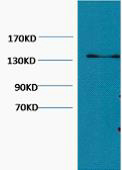 Collagen III Monoclonal Antibody(Q76)