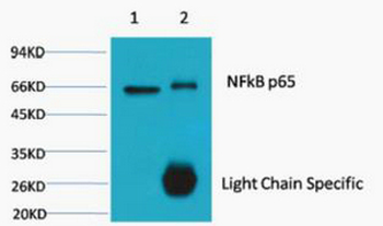 NFkB p65 Monoclonal Antibody(5G6)