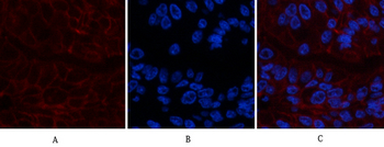 CA IX Monoclonal Antibody(12F10)