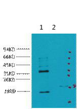 CA IX Monoclonal Antibody(12F10)