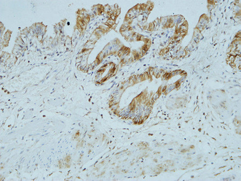 CA IX Monoclonal Antibody(12F10)