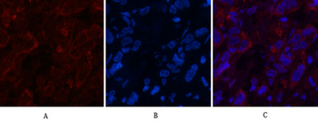 AFP alpha 1 Fetoprotein Monoclonal Antibody(17C5)