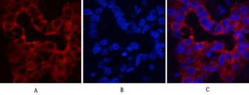 CK16 Monoclonal Antibody(6F6)