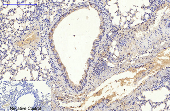 HSP70 Monoclonal Antibody(3G10)