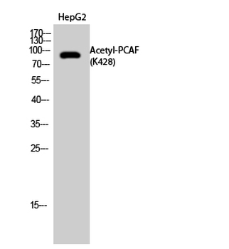 PCAF (Acetyl Lys428) Polyclonal Antibody