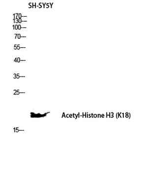 Histone H3 (Acetyl Lys18) Polyclonal Antibody