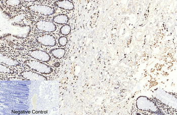 Histone H3 (Acetyl Lys9) Polyclonal Antibody