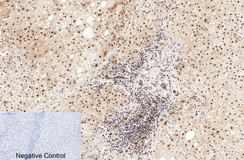 Cleaved-PARP-1 (D214) Polyclonal Antibody