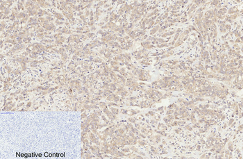 Cleaved-Caspase-8 (D384) Polyclonal Antibody