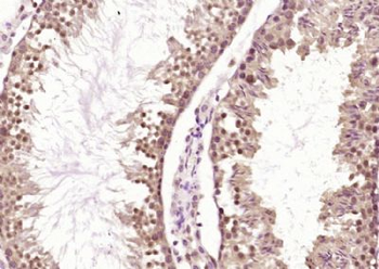 WDFY3 Polyclonal Antibody