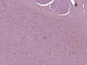 Thymosin beta 4 Polyclonal Antibody