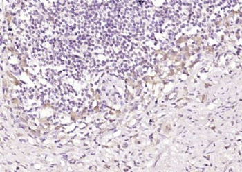 DENND2D Polyclonal Antibody