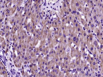 SARM1 Polyclonal Antibody