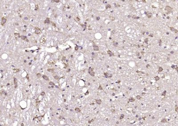 GNAI2/G protein alpha inhibitor 1 Polyclonal Antibody