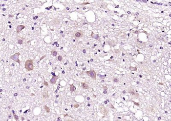 LRRC59 Polyclonal Antibody
