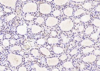 UBE2V1 Polyclonal Antibody