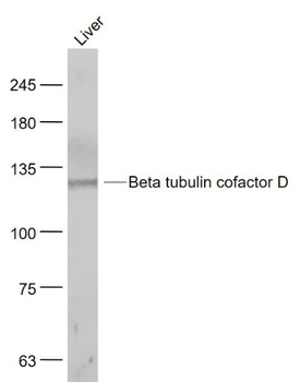 Beta tubulin cofactor D Polyclonal Antibody