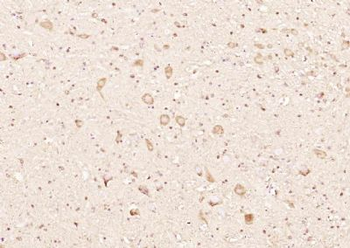 RINT1 Polyclonal Antibody