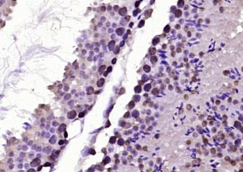 BRD7 Polyclonal Antibody