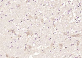 AMSH Polyclonal Antibody