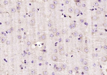 DAD1 Polyclonal Antibody