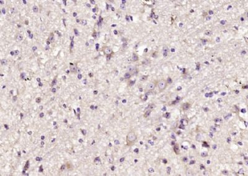 DAD1 Polyclonal Antibody