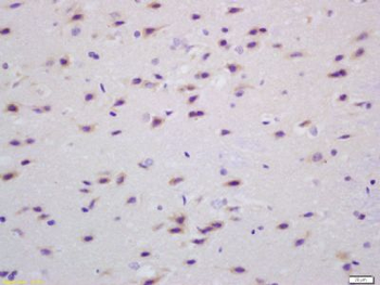 Transglutaminase-1 Polyclonal Antibody