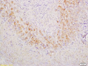GCET2 Polyclonal Antibody