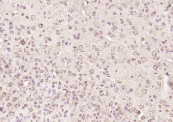 TP53I13 Polyclonal Antibody