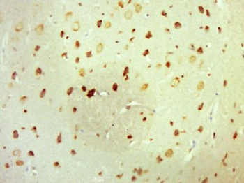 Laminin alpha 1 Polyclonal Antibody