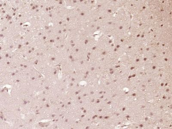 SETBP1 Polyclonal Antibody