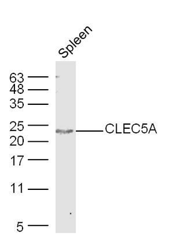 CLEC5A Polyclonal Antibody