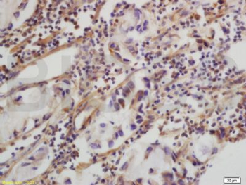 CLEC5A Polyclonal Antibody