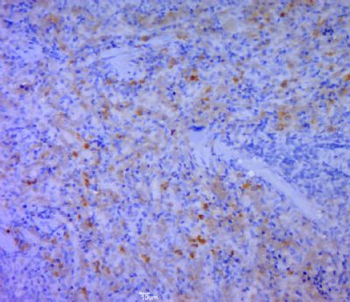 CD5L Polyclonal Antibody