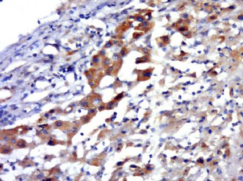 MIP3/CCL23 Polyclonal Antibody