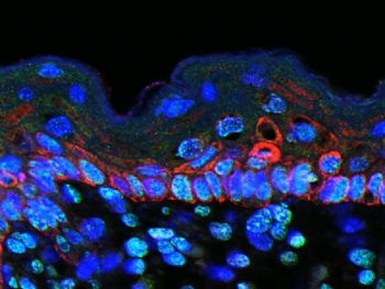 Macrophage Inflammatory Protein 1 gamma Polyclonal Antibody