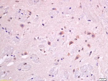 Macrophage Inflammatory Protein 1 gamma Polyclonal Antibody