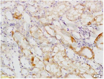 Uromucoid Polyclonal Antibody