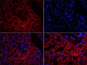 Uromucoid Polyclonal Antibody